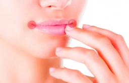 Επιληπτικές κρίσεις στις γωνίες του στόματος: αιτίες και θεραπεία