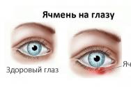 Como tratar a cevada nos olhos em adultos e crianças?