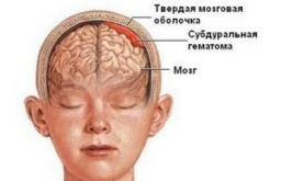 Zdravljenje bule na čelu otroka zaradi udarca